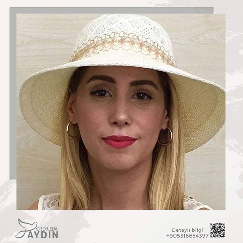 Eda Aydın