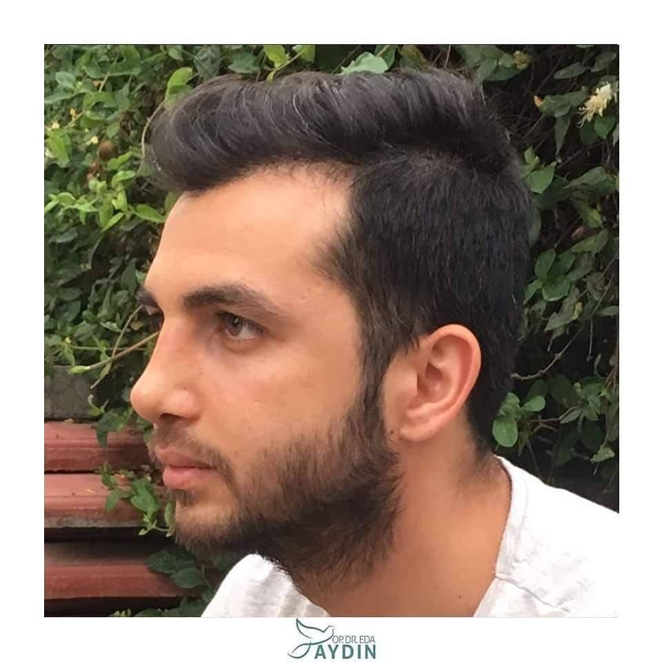 Eda Aydın