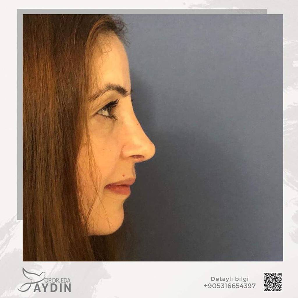 Eda Aydın