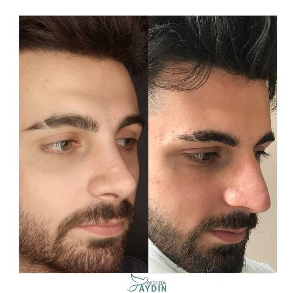 Eda Aydın