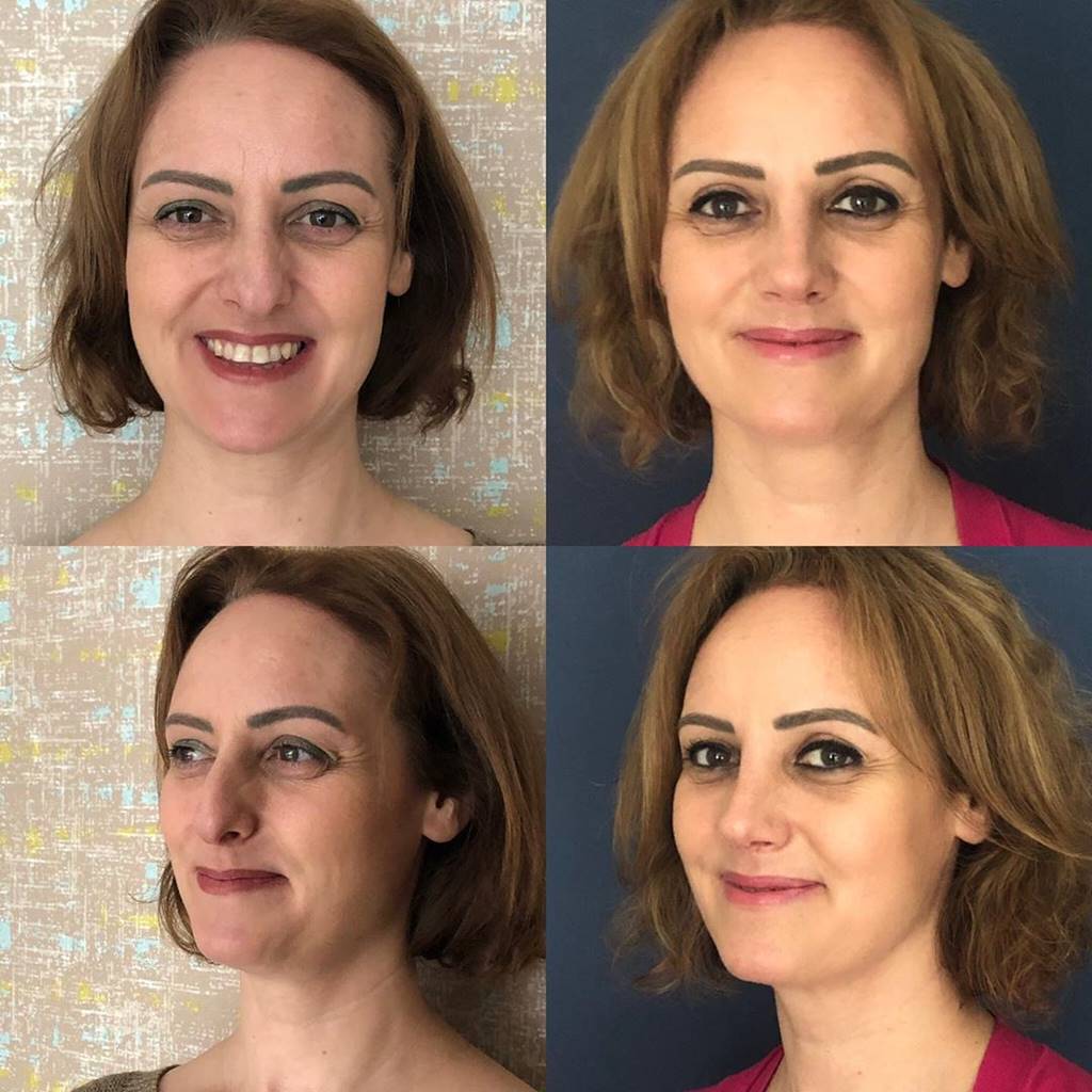 Eda Aydın