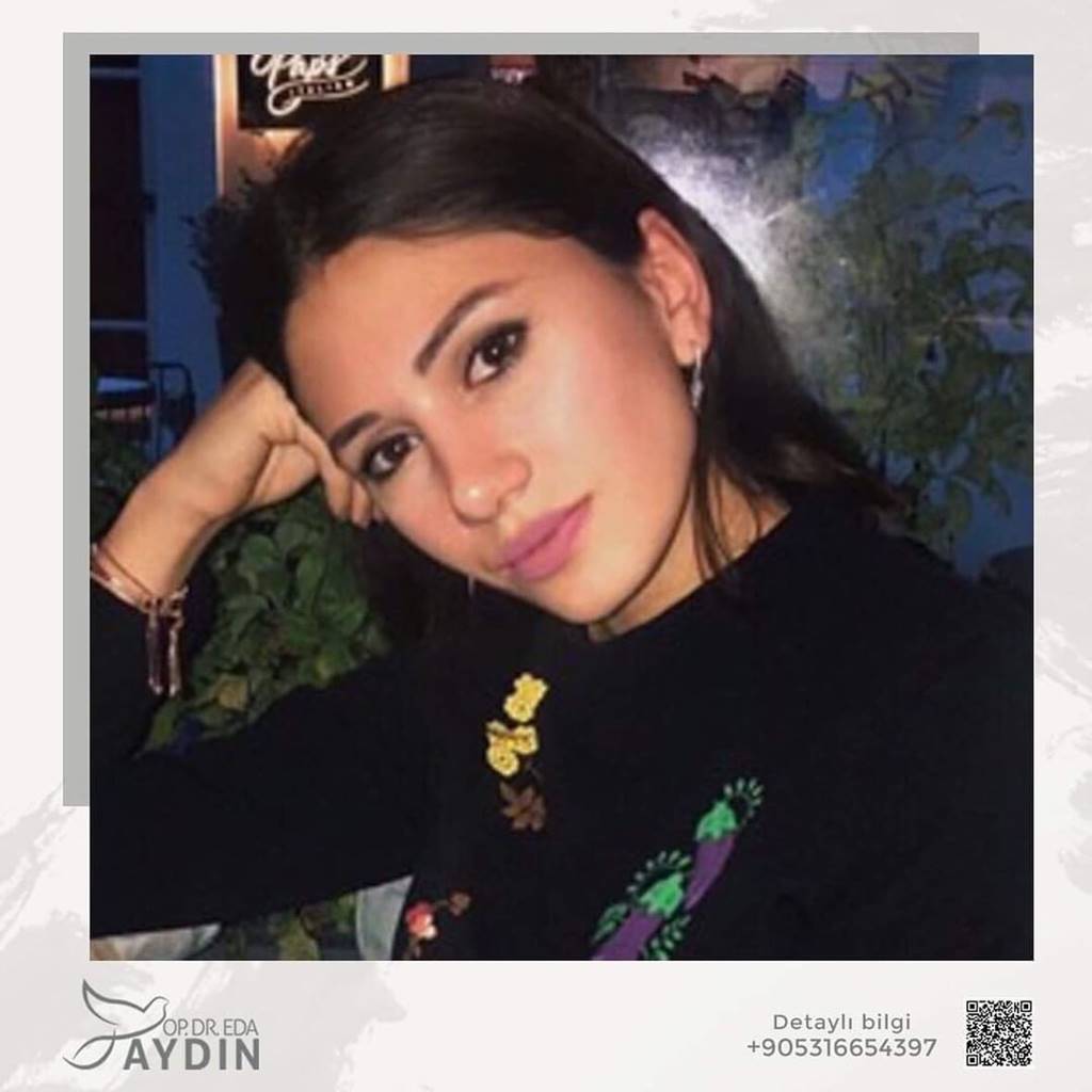 Eda Aydın