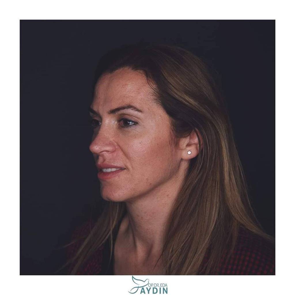 Eda Aydın