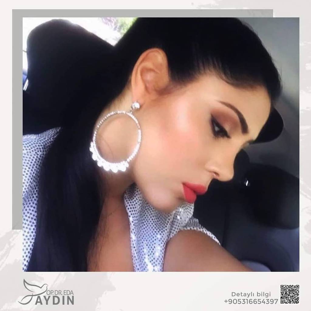 Eda Aydın