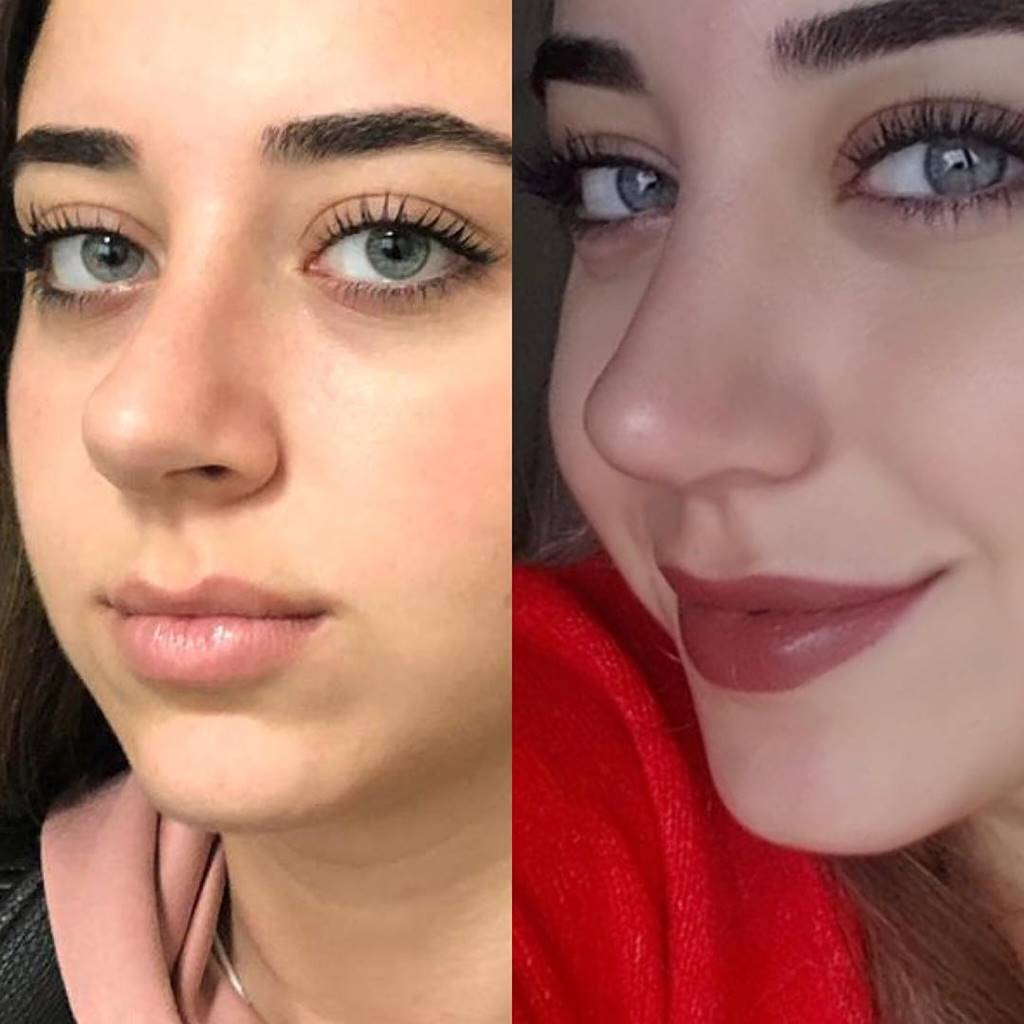 Eda Aydın