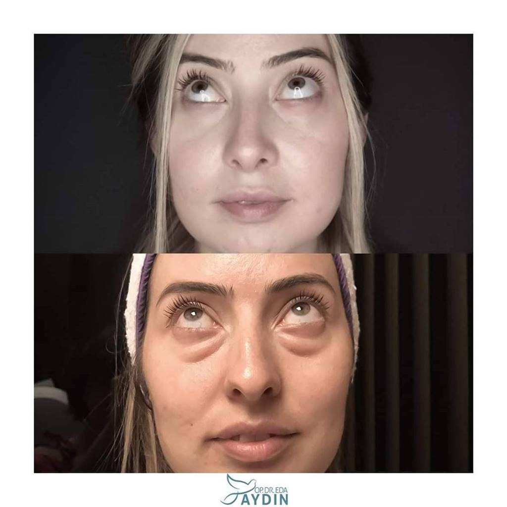 Eda Aydın