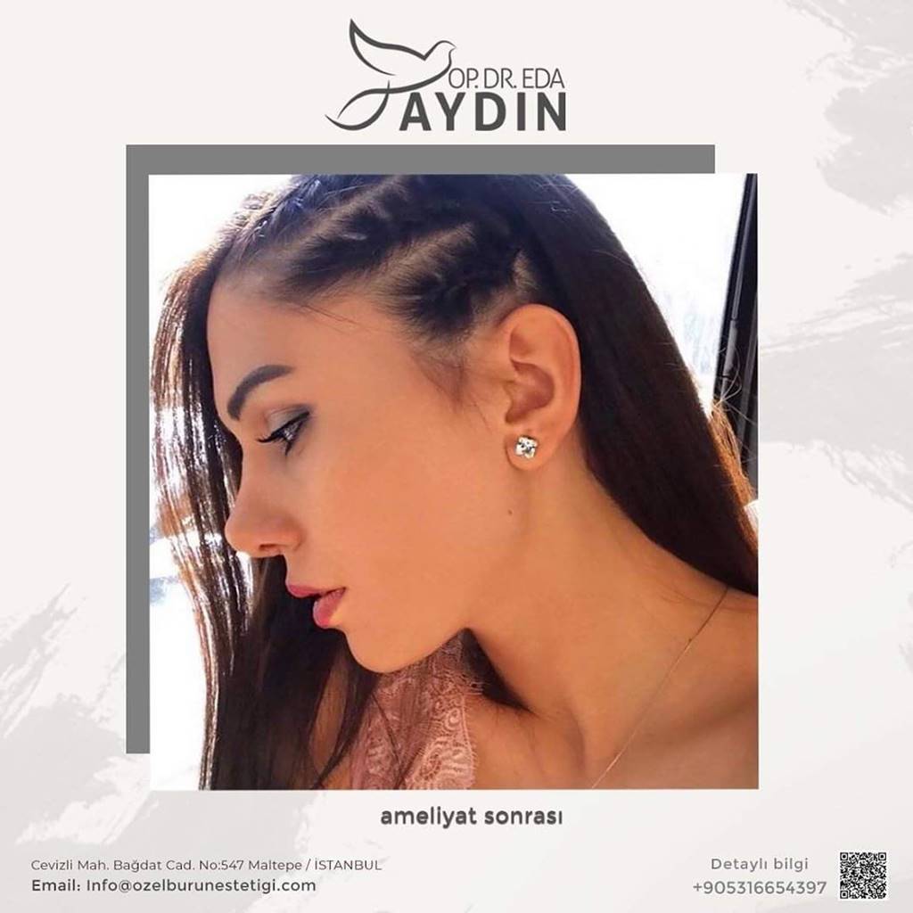 Eda Aydın