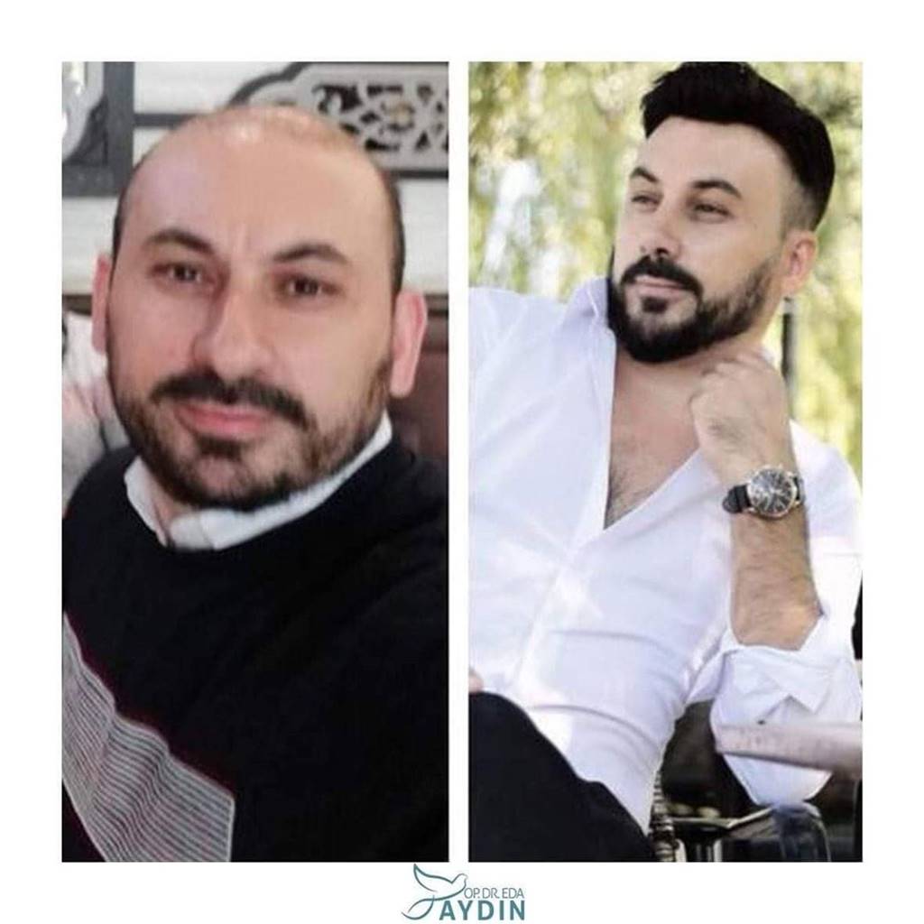 Eda Aydın