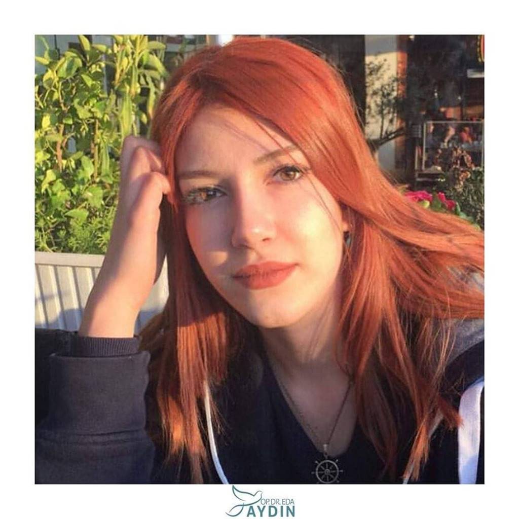 Eda Aydın