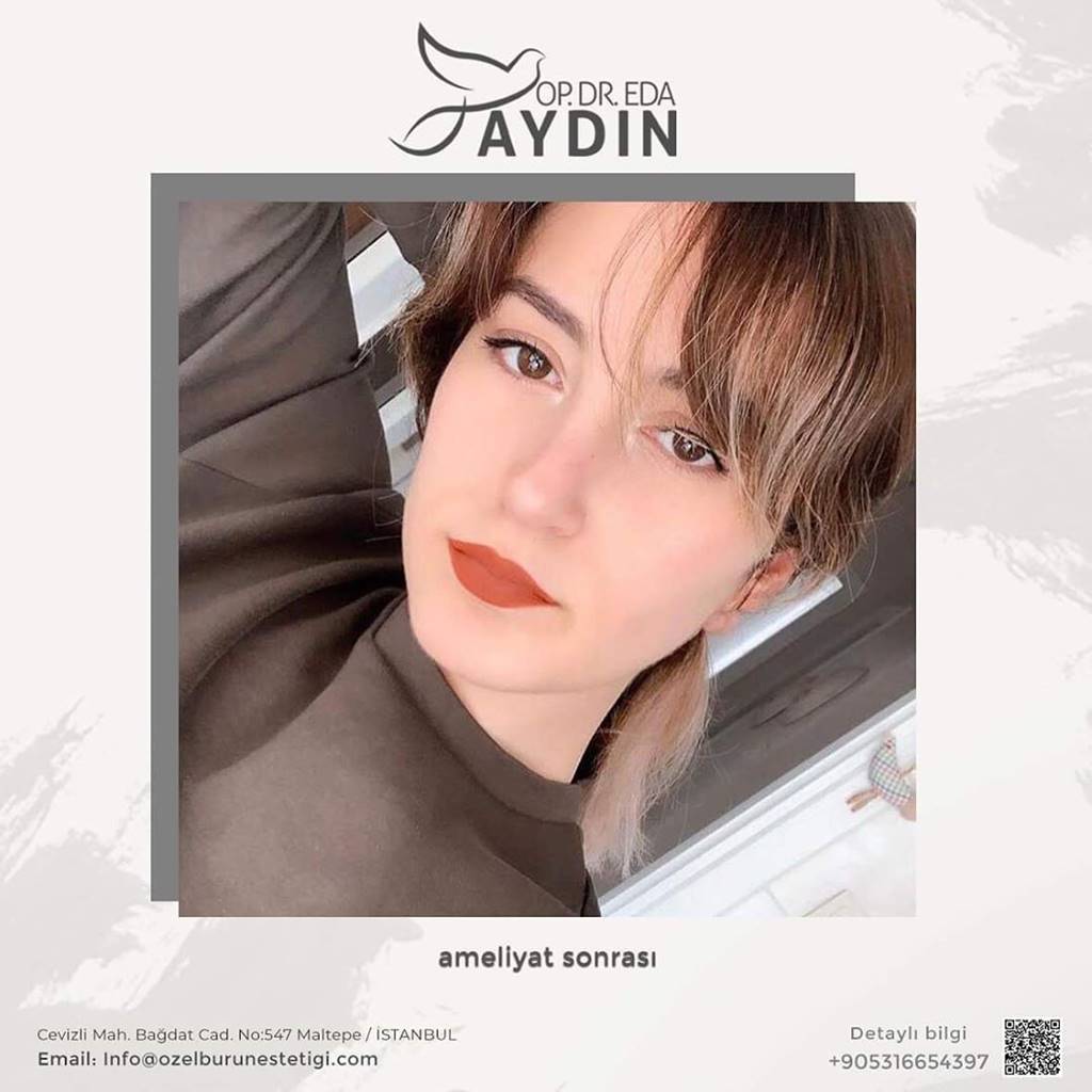 Eda Aydın