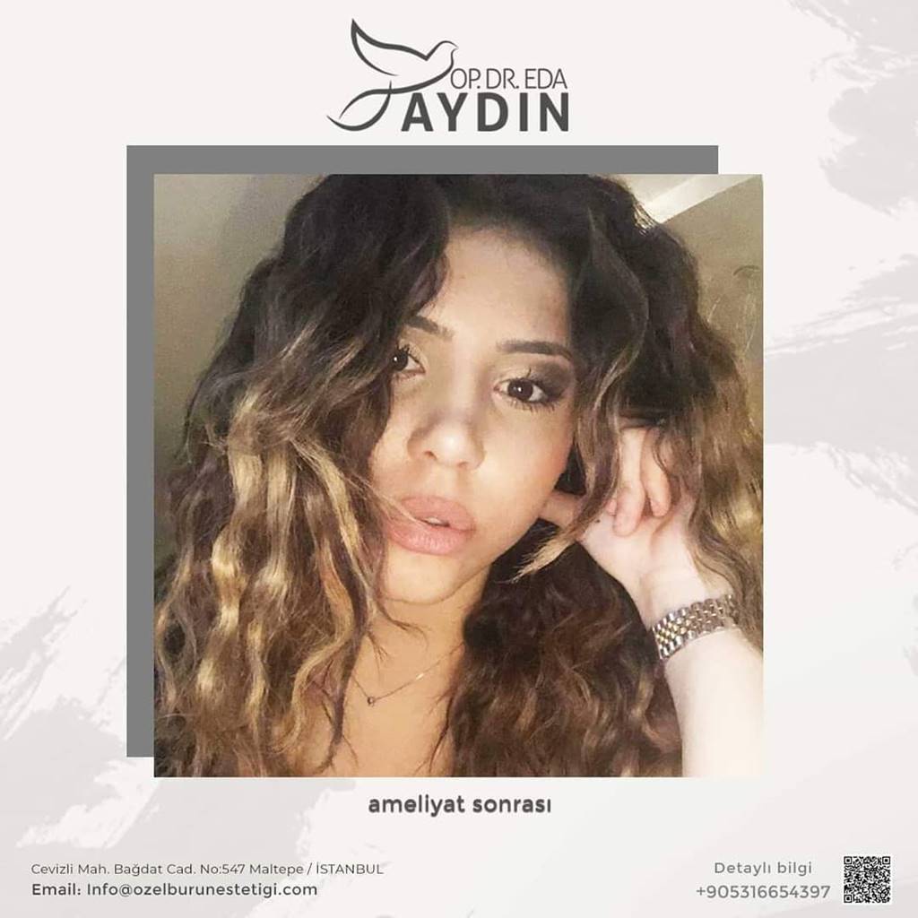 Eda Aydın